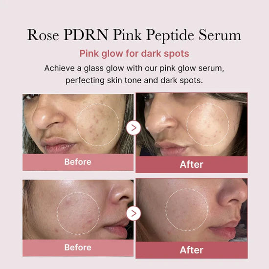 MEDICUBE PDRN Pink Serum 30ml