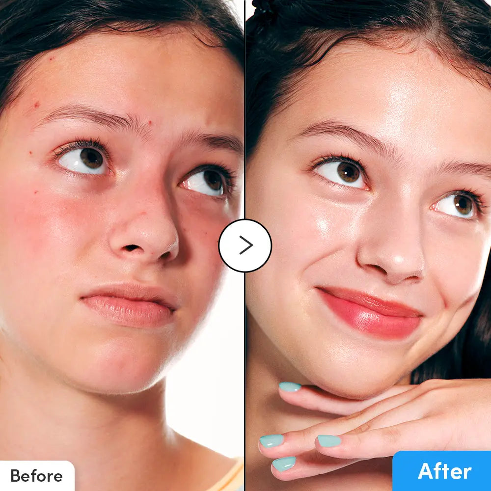EQUALBERRY Blue Blow Hyaltoin Flooding Serum