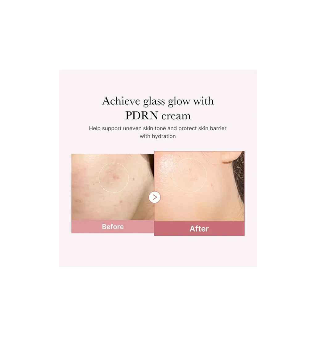 MEDICUBE PDRN Pink Hyaluronic Moisturizing Cream 50ml